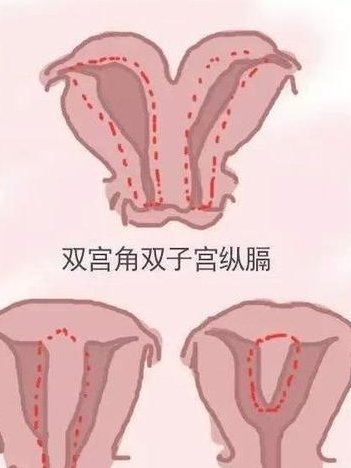 澳门试管机构能做三代试管婴儿吗？需要多少钱看完就知道