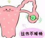 输卵管堵塞能否试管移植？关键因素大揭秘！