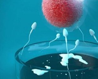 男的不育不孕全部检查报告（男的不育不孕全部检查报告怎么看）